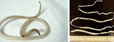 Arten von Parasiten im menschlichen Körper